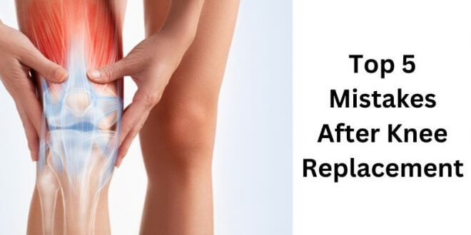 Top 5 Mistakes After Knee Replacement